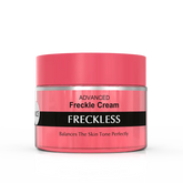 Vince Advanced Freckle Cream